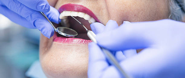 Best Emergency Tooth Extraction in Union City, OH
