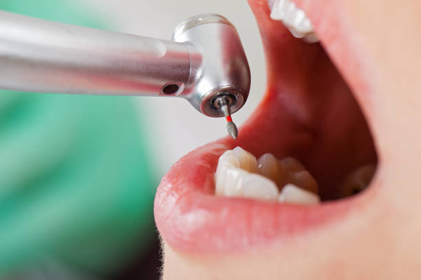 Best Emergency Dental Surgery in Union City, OH